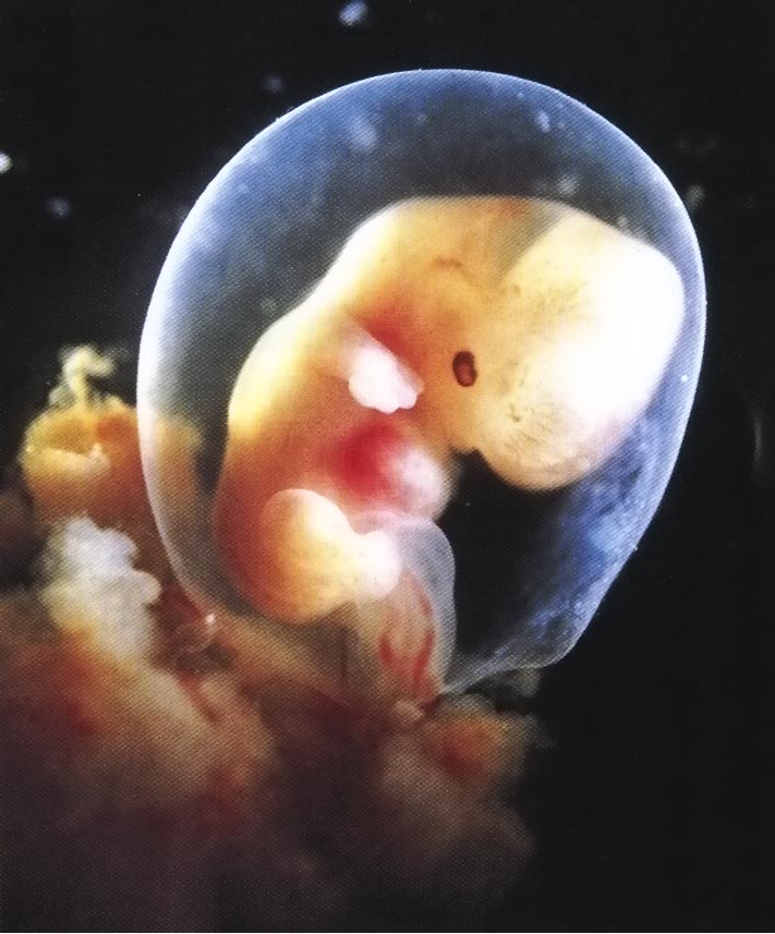 embryo baby