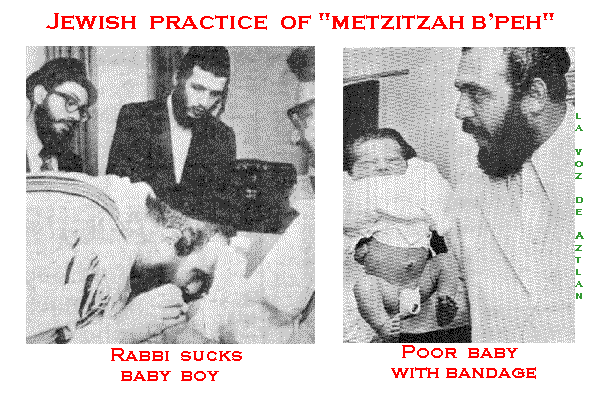 Image result for rabbi bites off foreskin